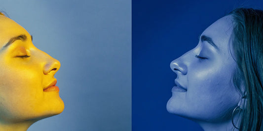 Woman's face before and after red light therapy for wrinkles.