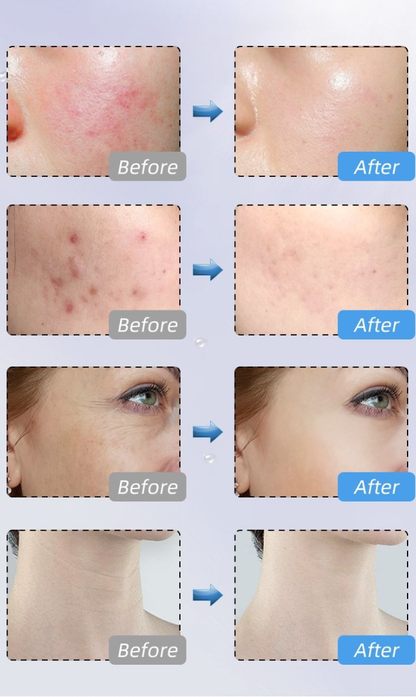 Before and after comparison of skin treatment effects on various parts of a person's face.