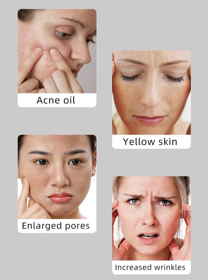 Novalight Pro LED Face Mask 2.0 - FDA Approved