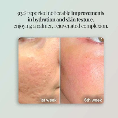 Novalight™ - Regenmask 2.0 Novalight-off 