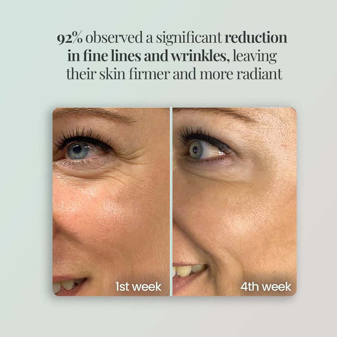 Novalight™ - Regenmask 2.0 Novalight-off 