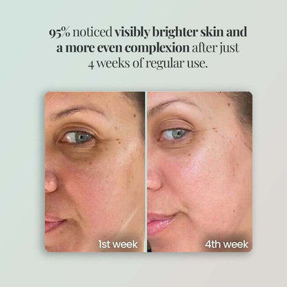 Novalight™ - Regenmask 2.0 Novalight-off 