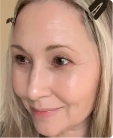 michelle_after_img_400x_788bfb1f-9ff7-410f-9bc3-7fa7849d6ab3